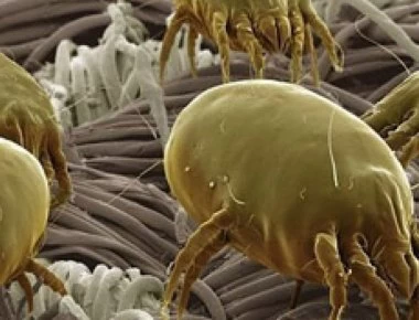 Θα τρομοκρατηθείς: Τα αηδιαστικά ακάρεα που ζούνε στο δέρμα μας (βίντεο)